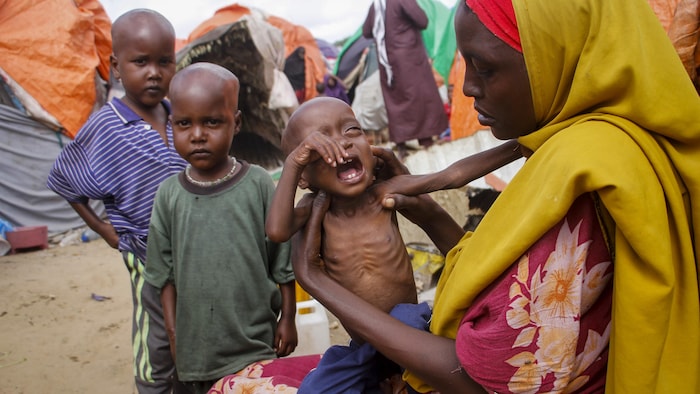 La Somalie Est Au Bord De La Famine Pr Vient Lonu Radio Canada