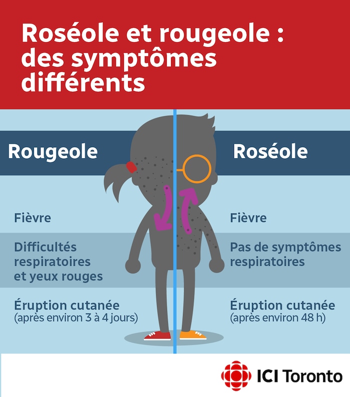 Votre enfant a t il la rougeole ou la roséole Savez vous les