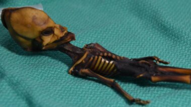 Le squelette du désert d'Atacama était une fille