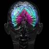IRM colorée d'un cerveau humain.