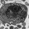 Image microscopique en noir et blanc d'un eucaryote qui a englouti une proie.