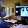 Une infirmière révise une radiographie de poumons d'un patient atteint de la COVID-19.
