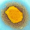 Le virus de la variole simienne vu au microscope.