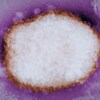 Micrographie électronique montrant une particule du virus de la variole simienne.