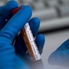 Un échantillon sanguin entre les mains d'un technicien de laboratoire avec des gants bleus.