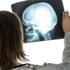 Médecin analysant une radiographie du crâne humain au bureau de l'hôpital pendant l'examen médical.