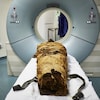La momie de Nesyamon a été scannée pour reconstituer son larynx.