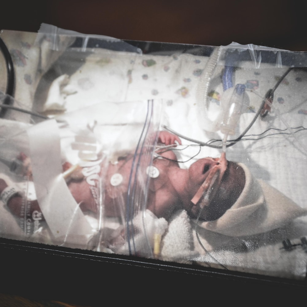 Un bébé prématuré dans un sac de plastique et connecté à des appareils. 