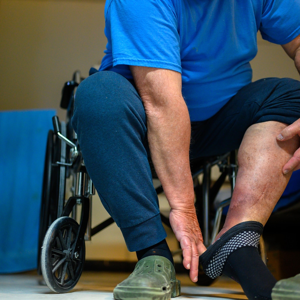 Un détenu âgé de plus de 80 ans en perte d’autonomie montre une de ses jambes.