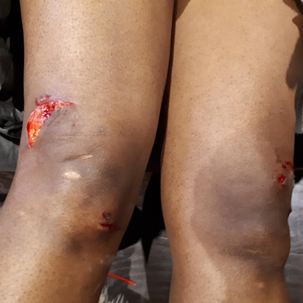 Les genoux meurtris de Mme Kamta