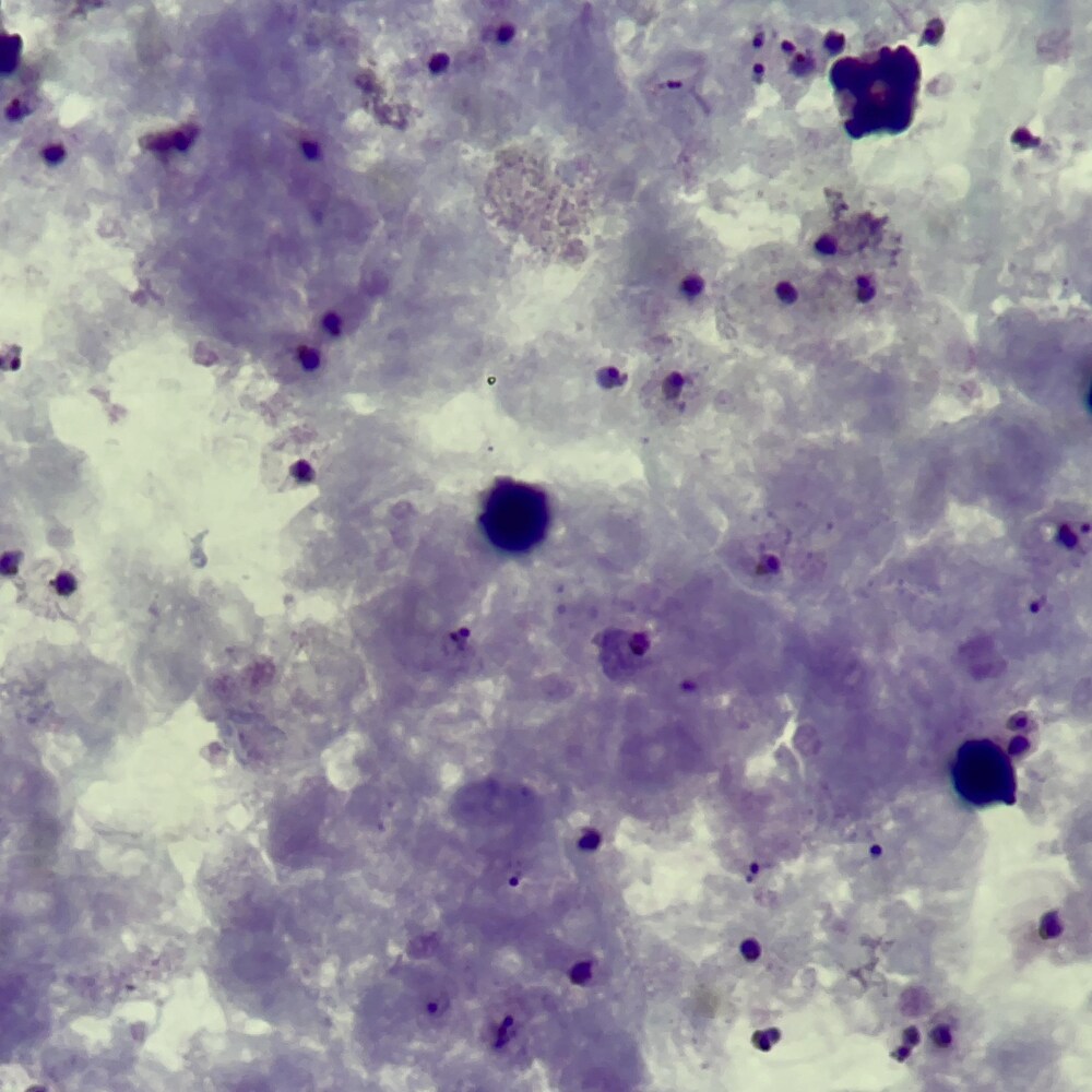 Vue d'un parasite à travers un microscope.