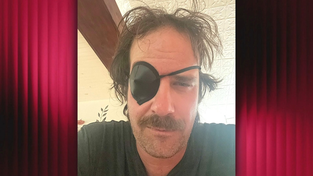 Robin-Joël Cool avec un cache-oeil.