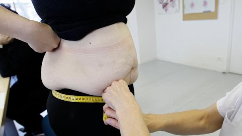 Selon le rapport du Réseau canadien de l’obésité, un patient obèse sur 806 a droit à une chirurgie bariatrique en Saskatchewan.