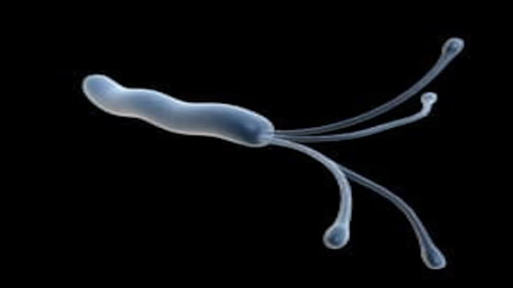 幽門螺桿菌(Helicobacter pylori)。