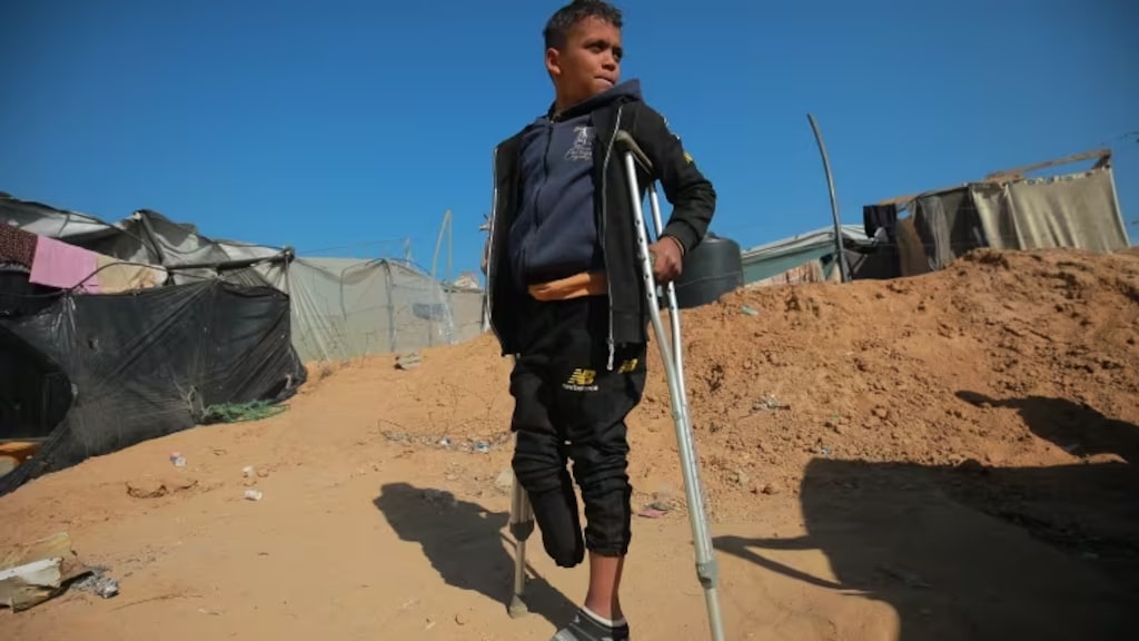 Api Shehda ’No one looks at me’: 12-year-old amputee in Gaza on what the war cost ...