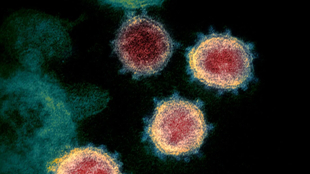 Une image microscopique des cellules du nouveau coronavirus. 