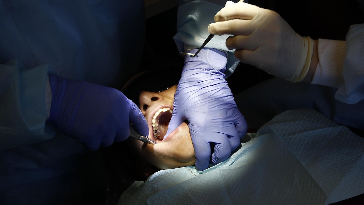 Une femme couchée sur le dos la bouche ouverte. Le dentiste met une main et un instrument dans sa bouche. 