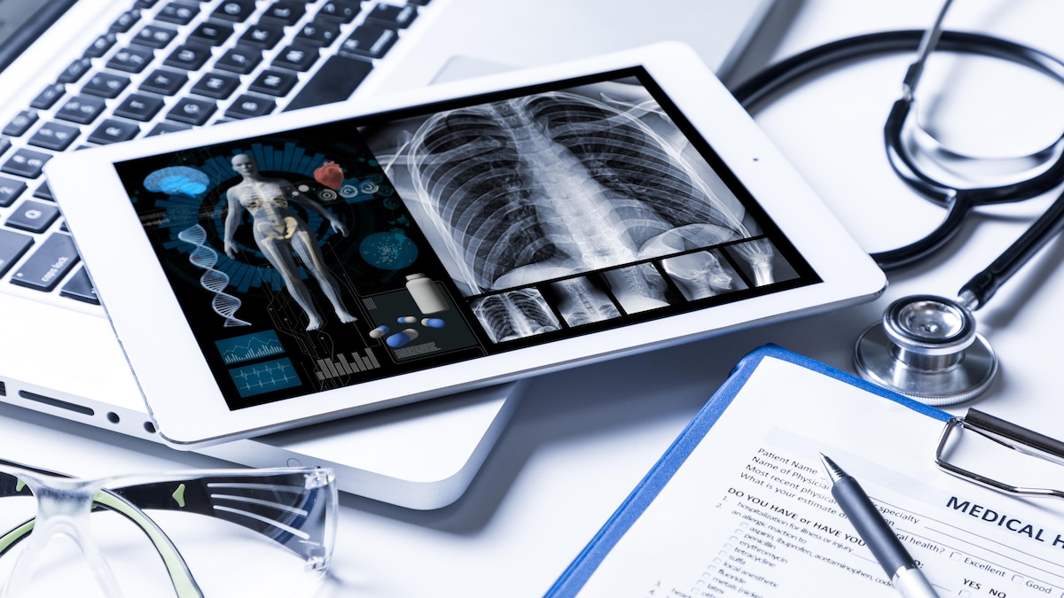 Une tablette électronique affichant une représentation du corps humain