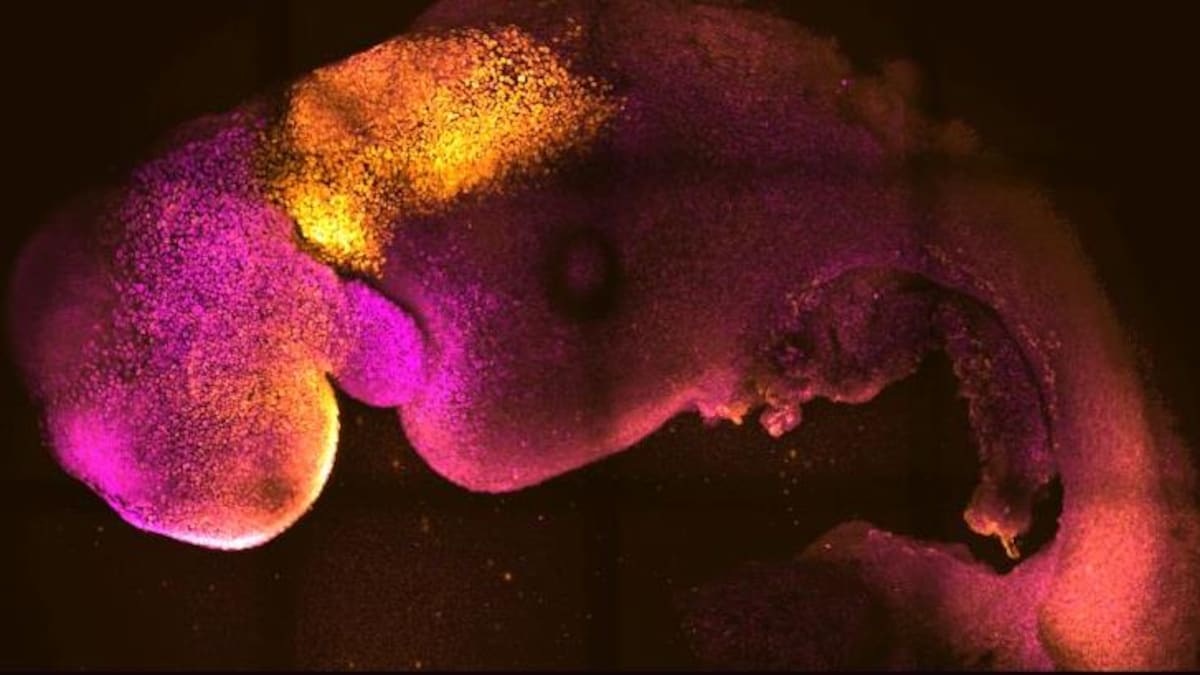Un embryon synthétique montrant la formation du cerveau et du cœur.