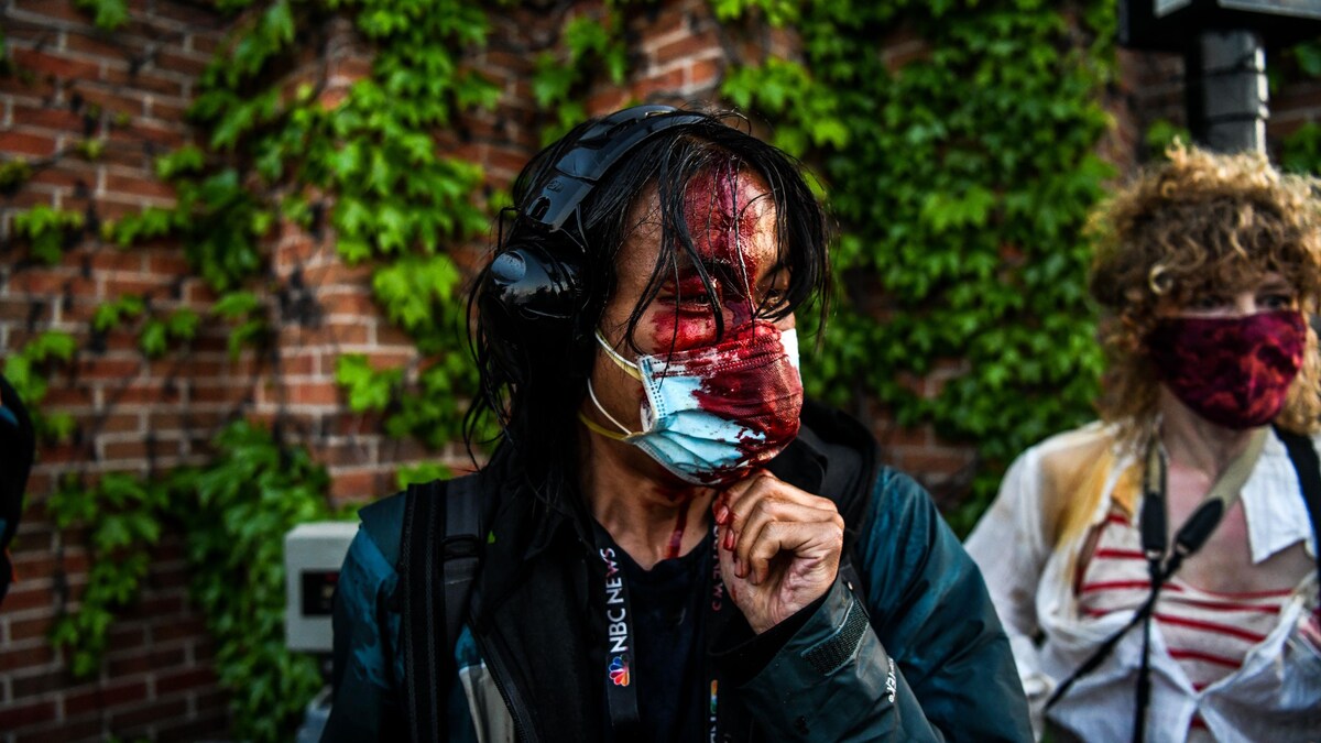 Une femme portant un masque et des écouteurs a le visage ensanglanté.