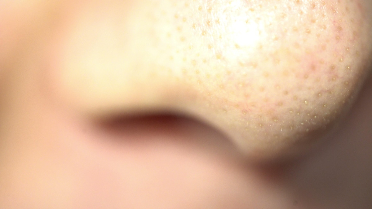 On voit en gros plan le nez d'un homme.
