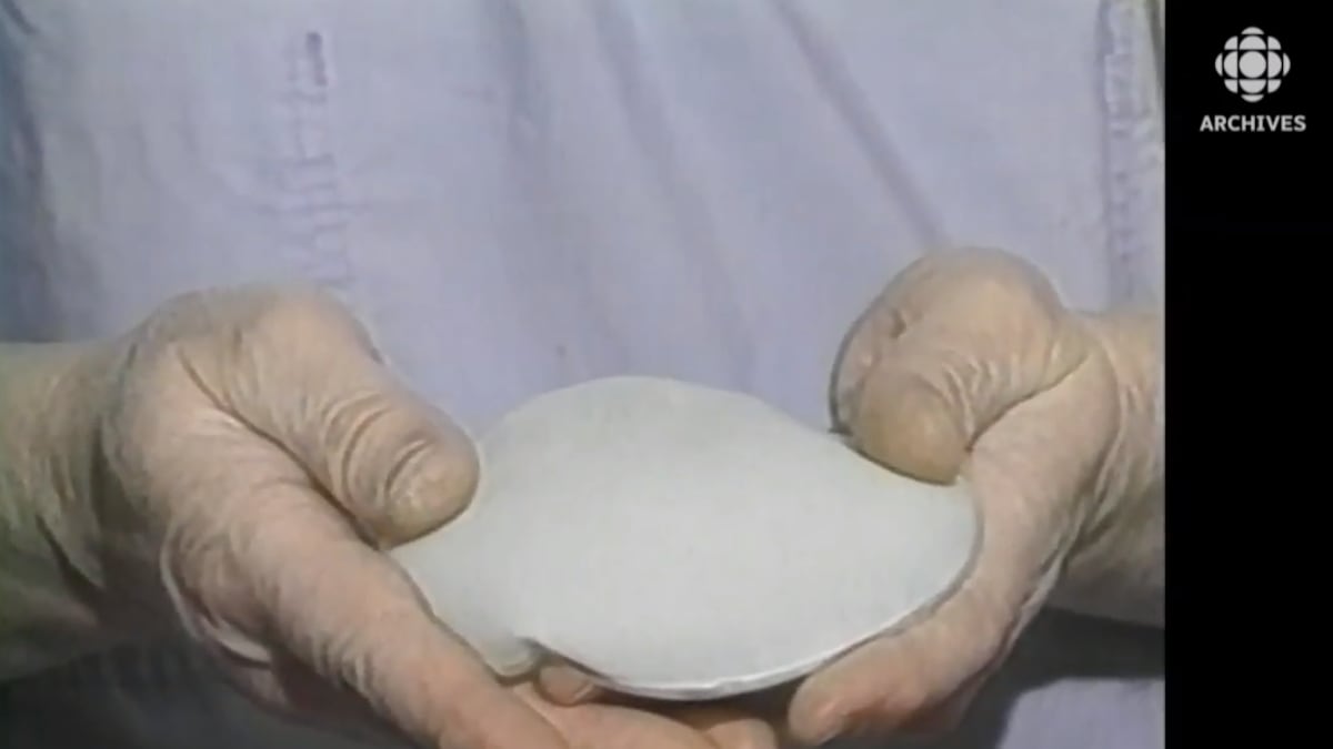 Deux mains tiennent un implant mammaire au gel de silicone texturé. 