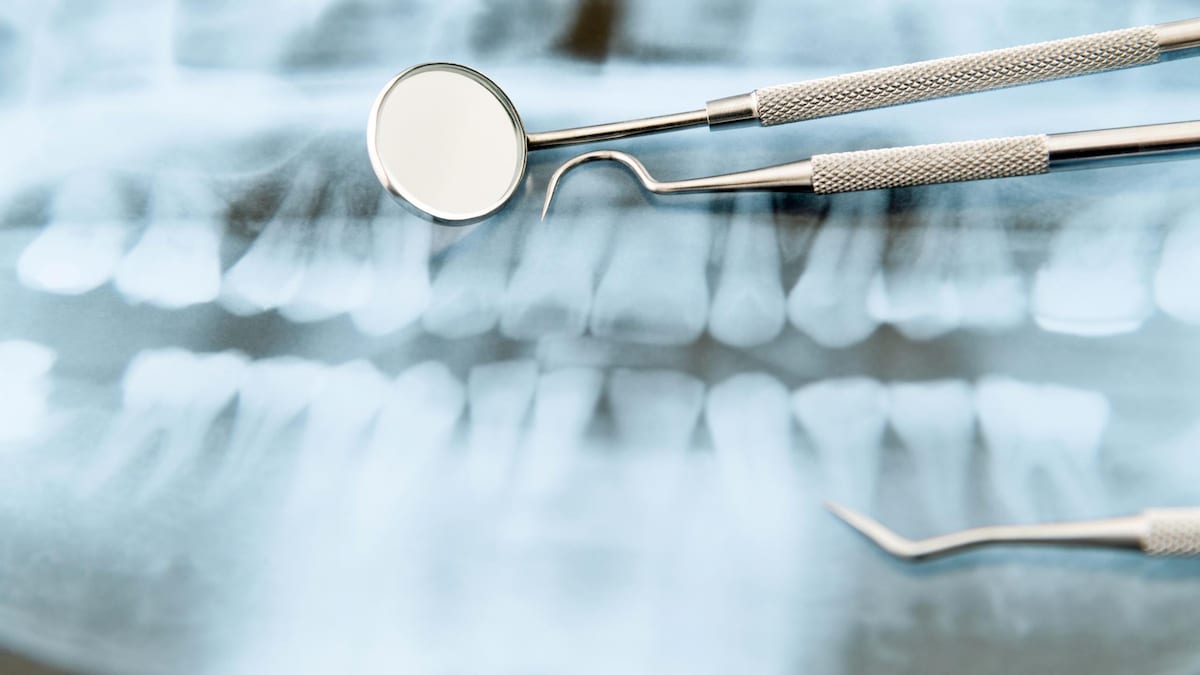Des outils de dentistes déposés sur une radiographie de dents.