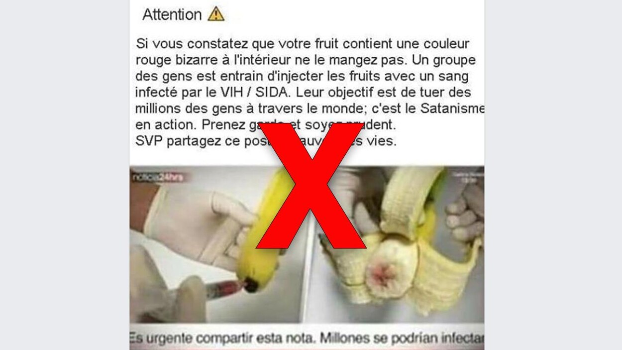 Bananes Infectées Au Vih Vous Devriez être Gêné Davoir