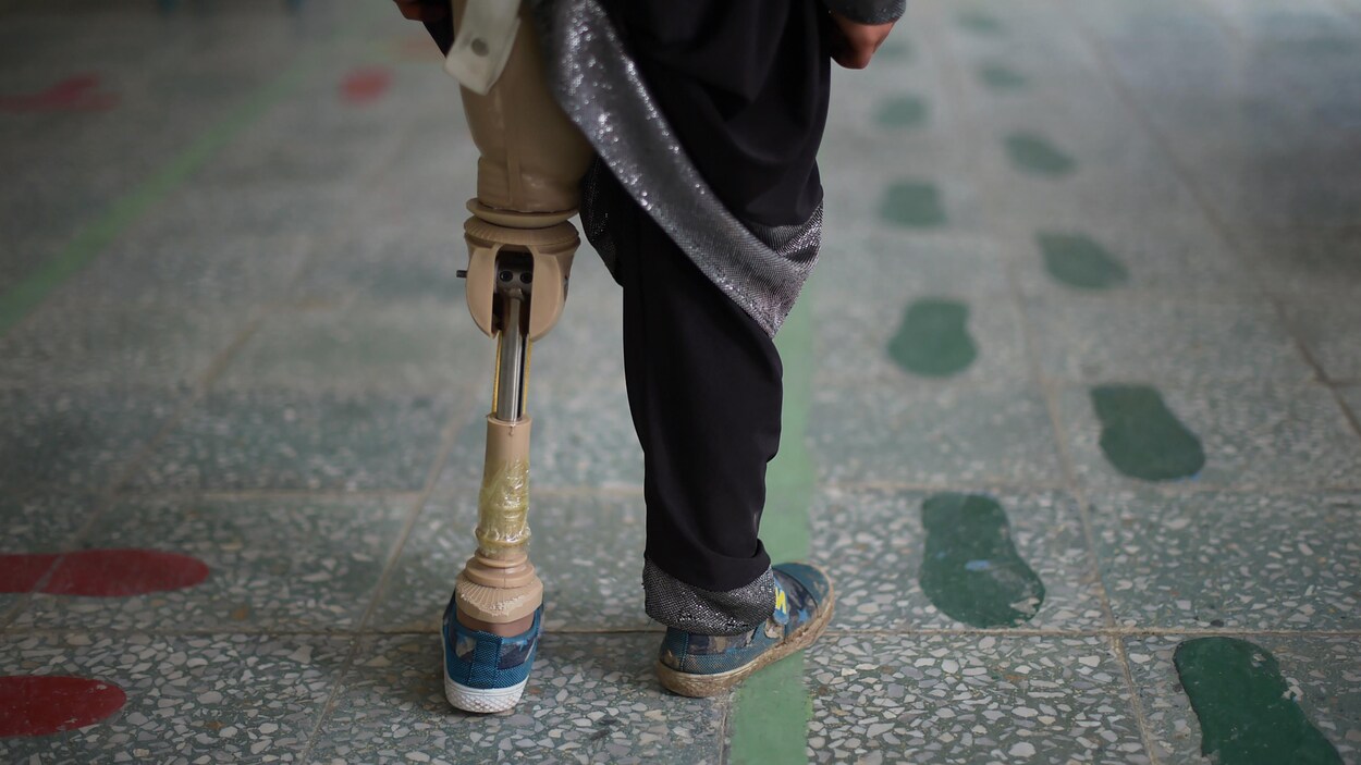 Une jeune Afghane déambule avec sa prothèse dans un hôpital de Kaboul. Une jeune Afghane déambule avec sa prothèse dans un hôpital de Kaboul.