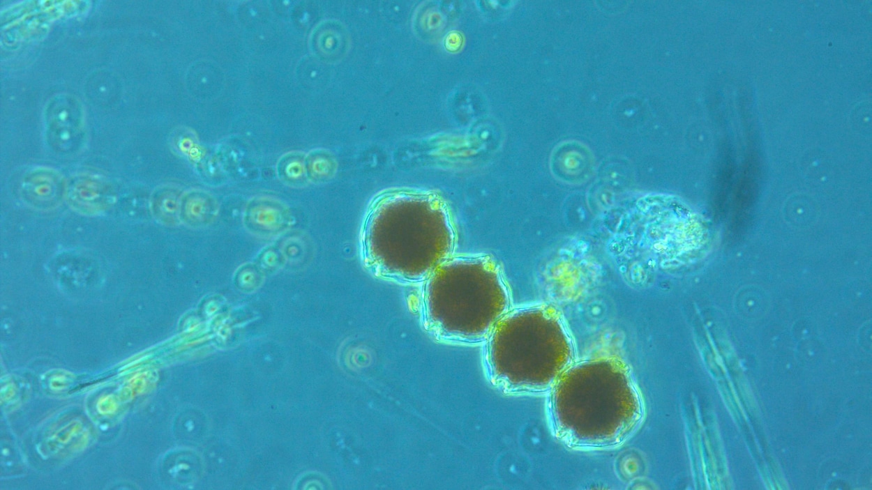 Quatre cellules au microscope.