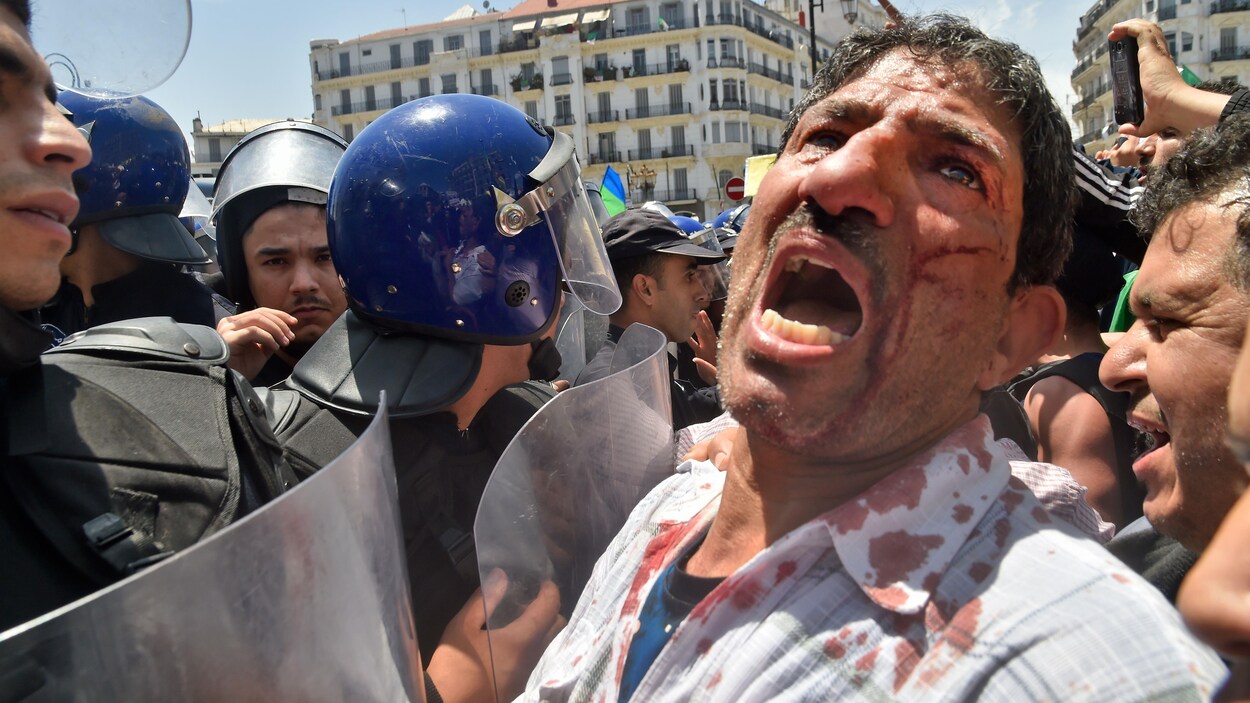 Un homme blessé crie devant des policiers antiémeute.