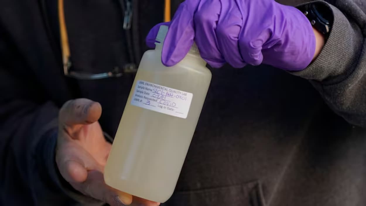 À la recherche du virus de la rougeole dans les eaux usées