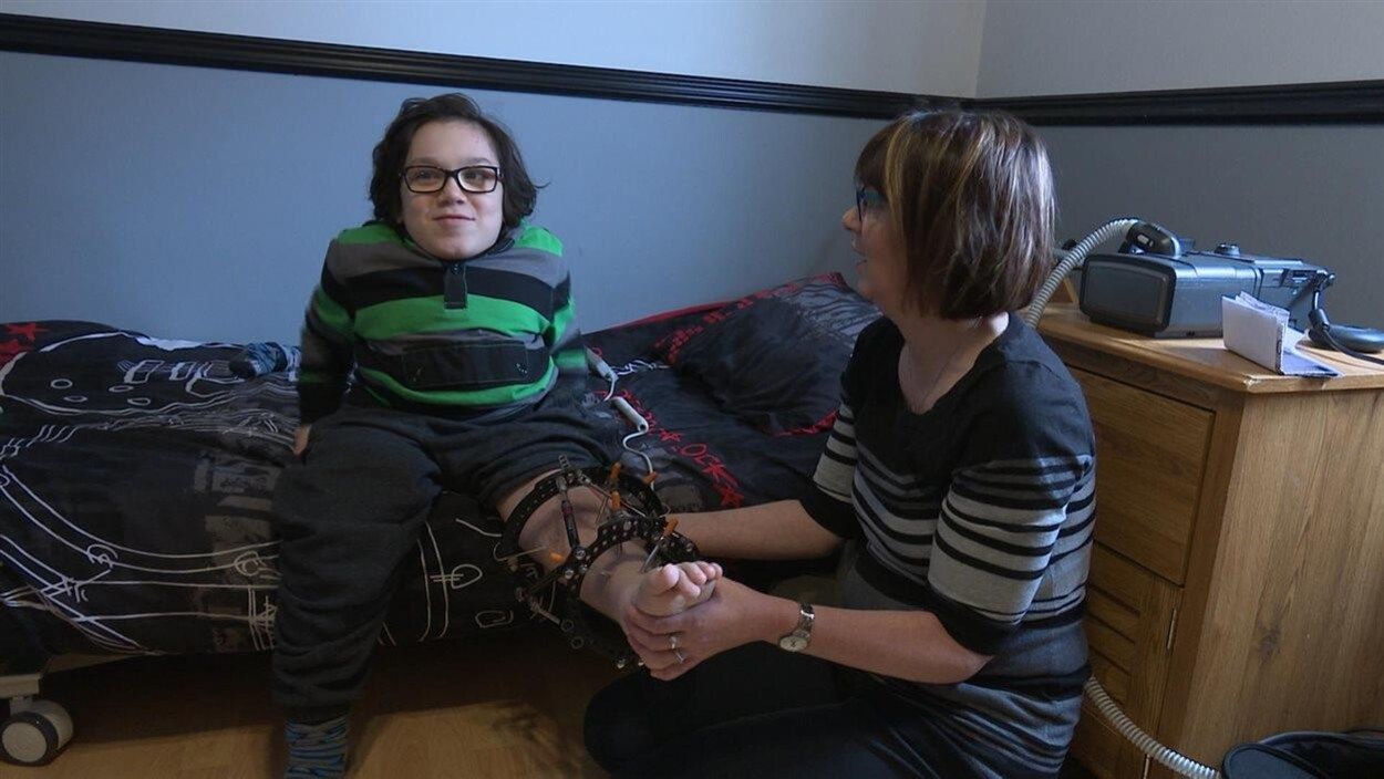 Anthony Lelievre, 13 ans, est atteint du syndrome de Morquio Anthony Lelievre, 13 ans, est atteint du syndrome de Morquio