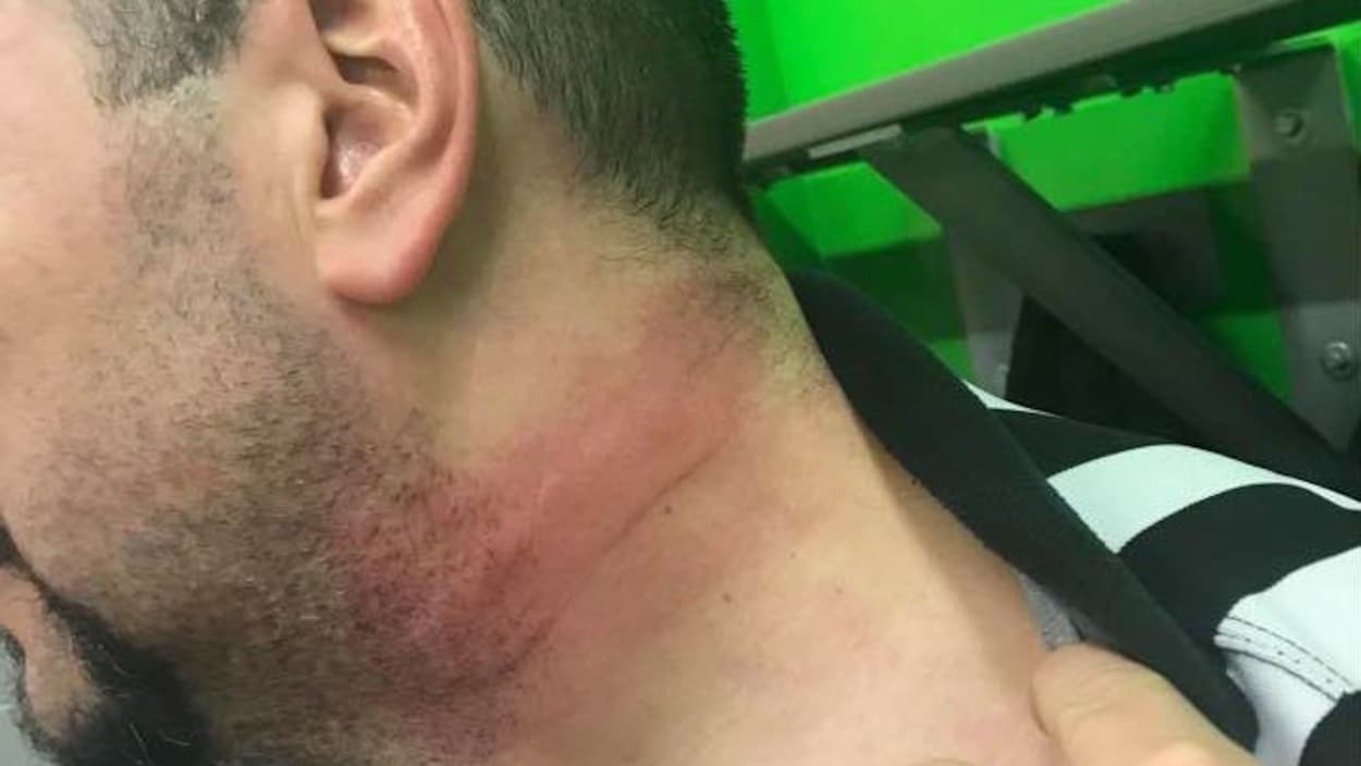 L'arbitre Benjamin Paradis a reçu un coup de bâton au coup à la toute fin d'une rencontre de hockey. L'arbitre Benjamin Paradis a reçu un coup de bâton au coup à la toute fin d'une rencontre de hockey.