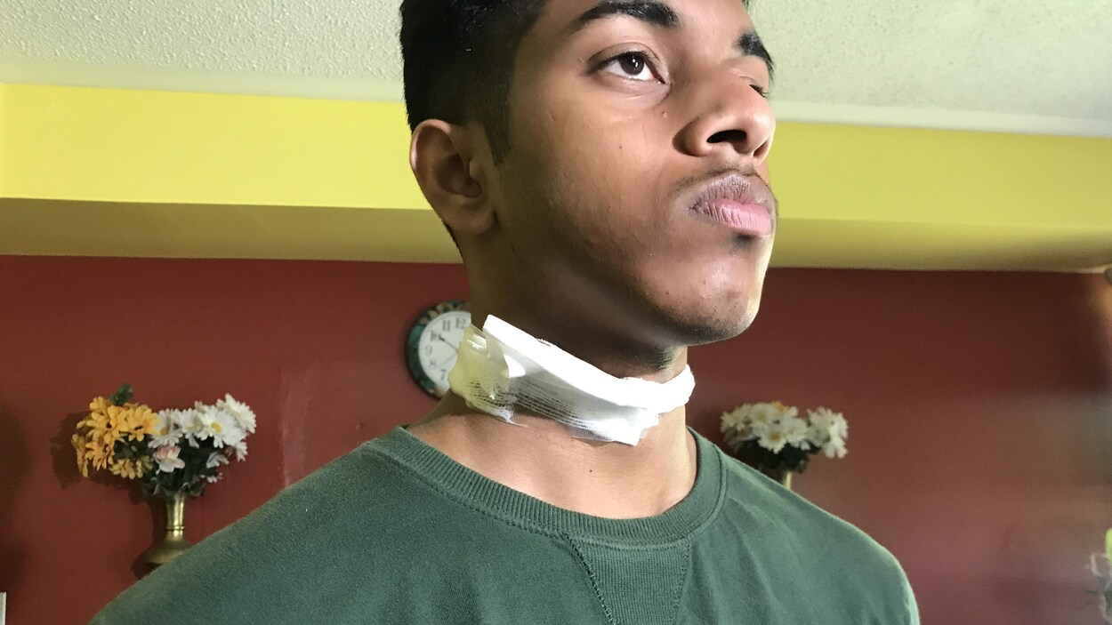 Photo d'un adolescent avec un bandage au cou Photo d'un adolescent avec un bandage au cou