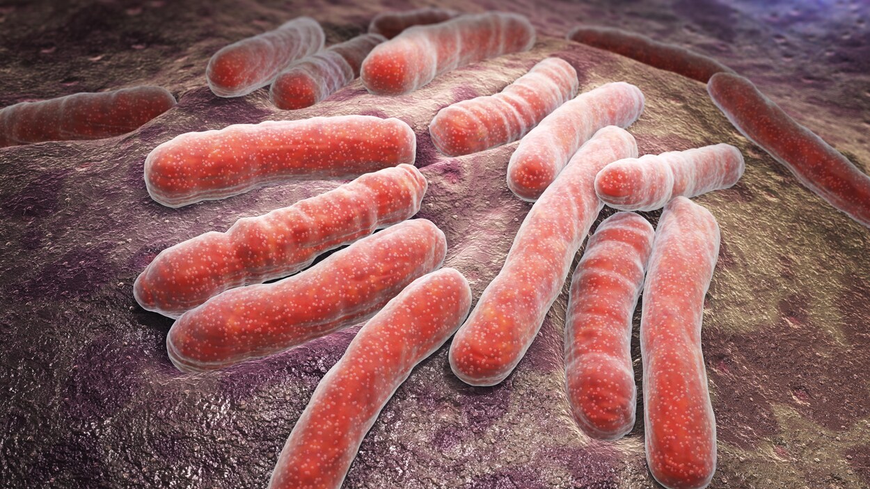 La bactérie de la tuberculose.