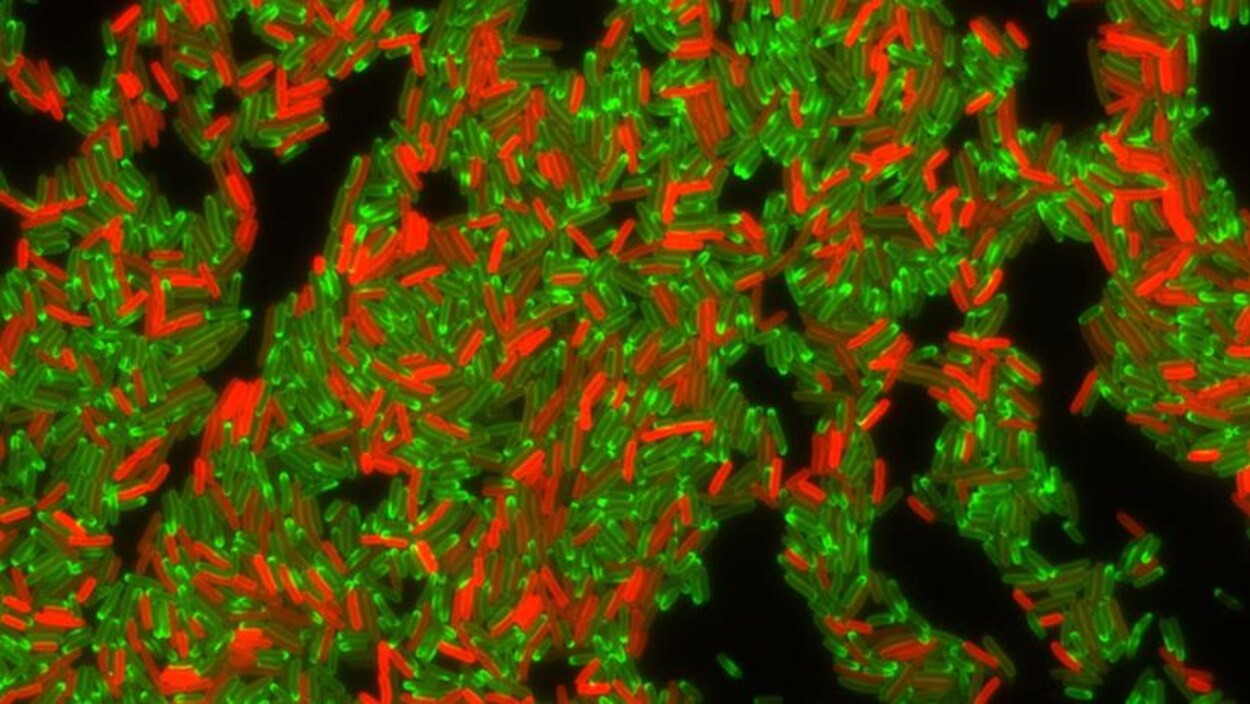 On voit des centaines de bactéries au microscope.