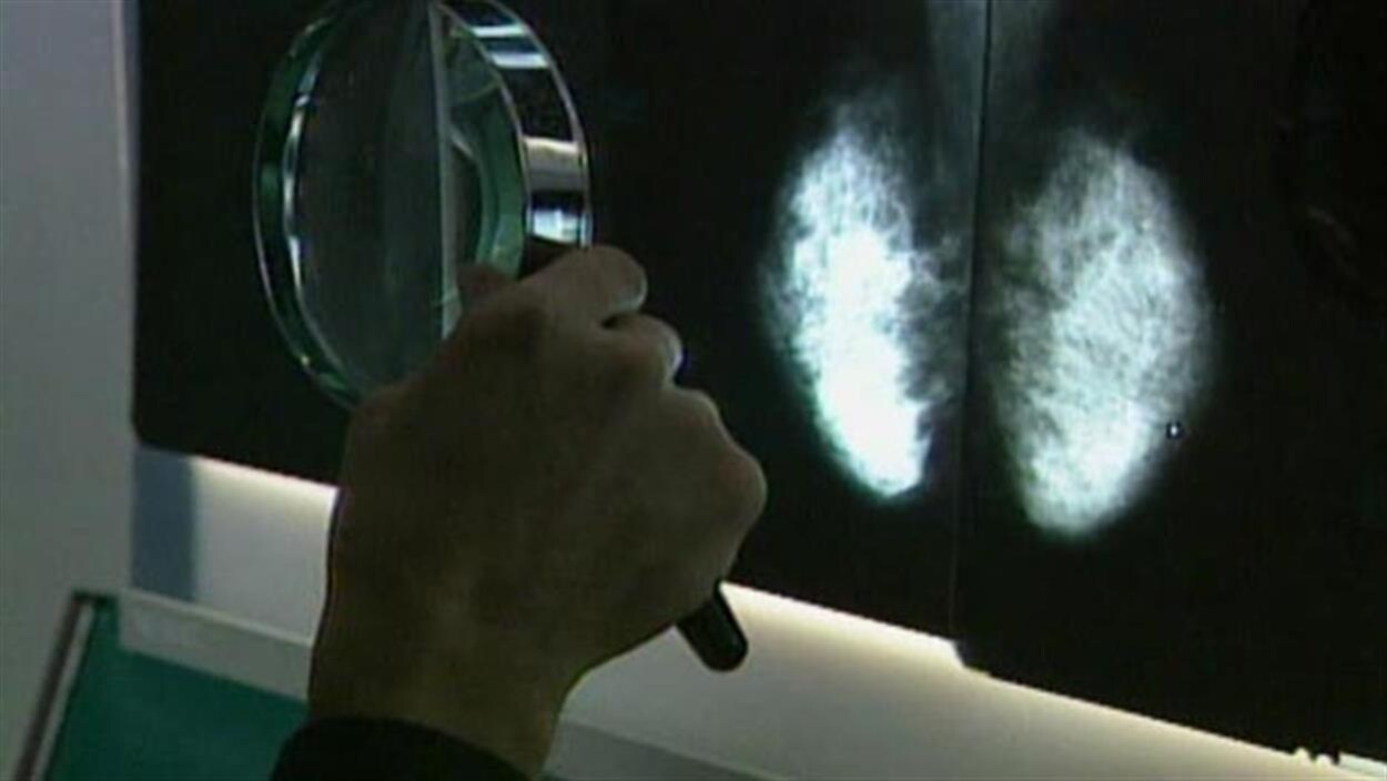 Un médecin examine une radiographie à l'aide d'une loupe.