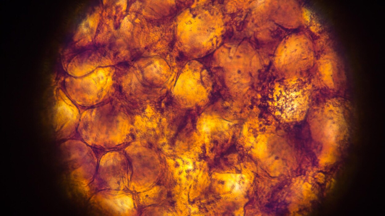 Des adipocytes au microscope. Des adipocytes au microscope.