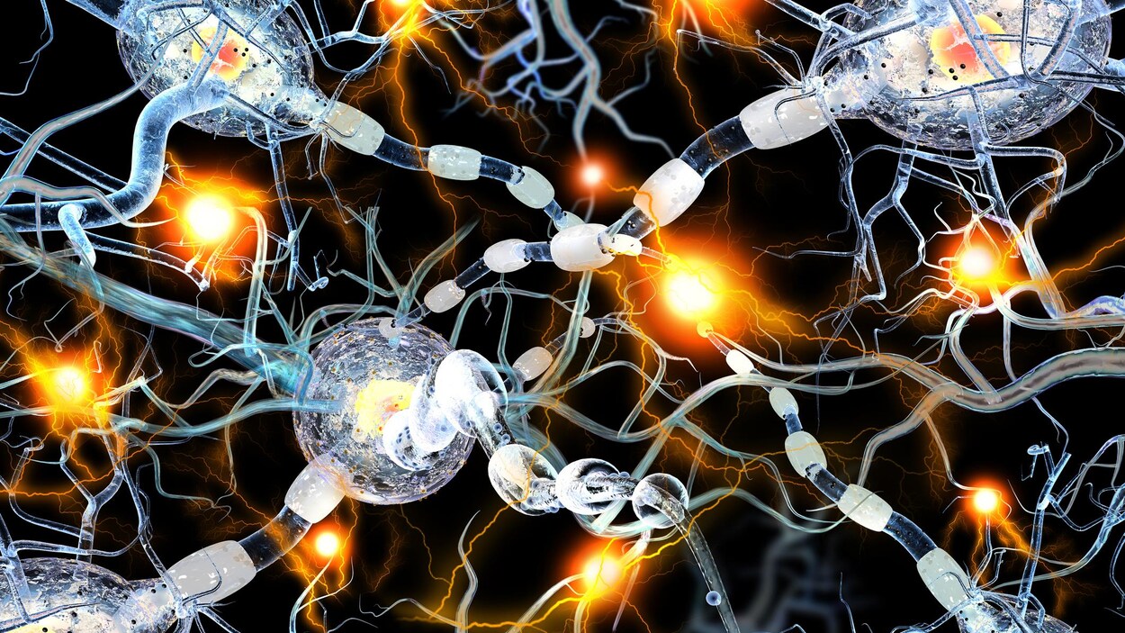Représentation artistique du mauvais fonctionnement des cellules cérébrales impliqué dans l'apparition de maladies neurodégénératives comme la maladie de Huntington. Représentation artistique du mauvais fonctionnement des cellules cérébrales impliqué dans l'apparition de maladies neurodégénératives comme la maladie de Huntington.