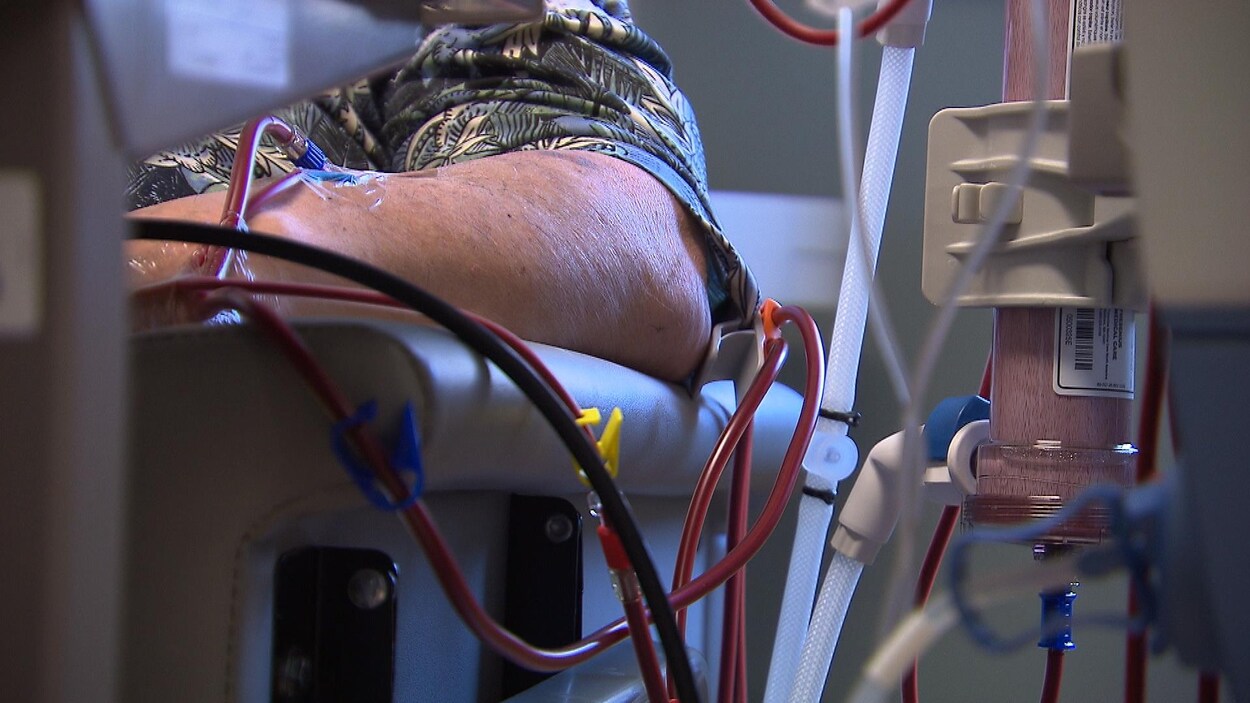 Un patient subit une dialyse.