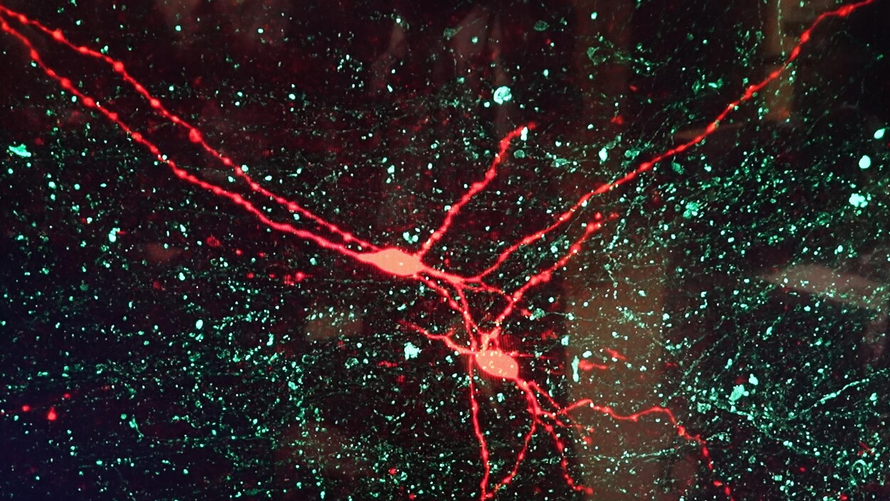 Des neurones d'un cerveau de souris