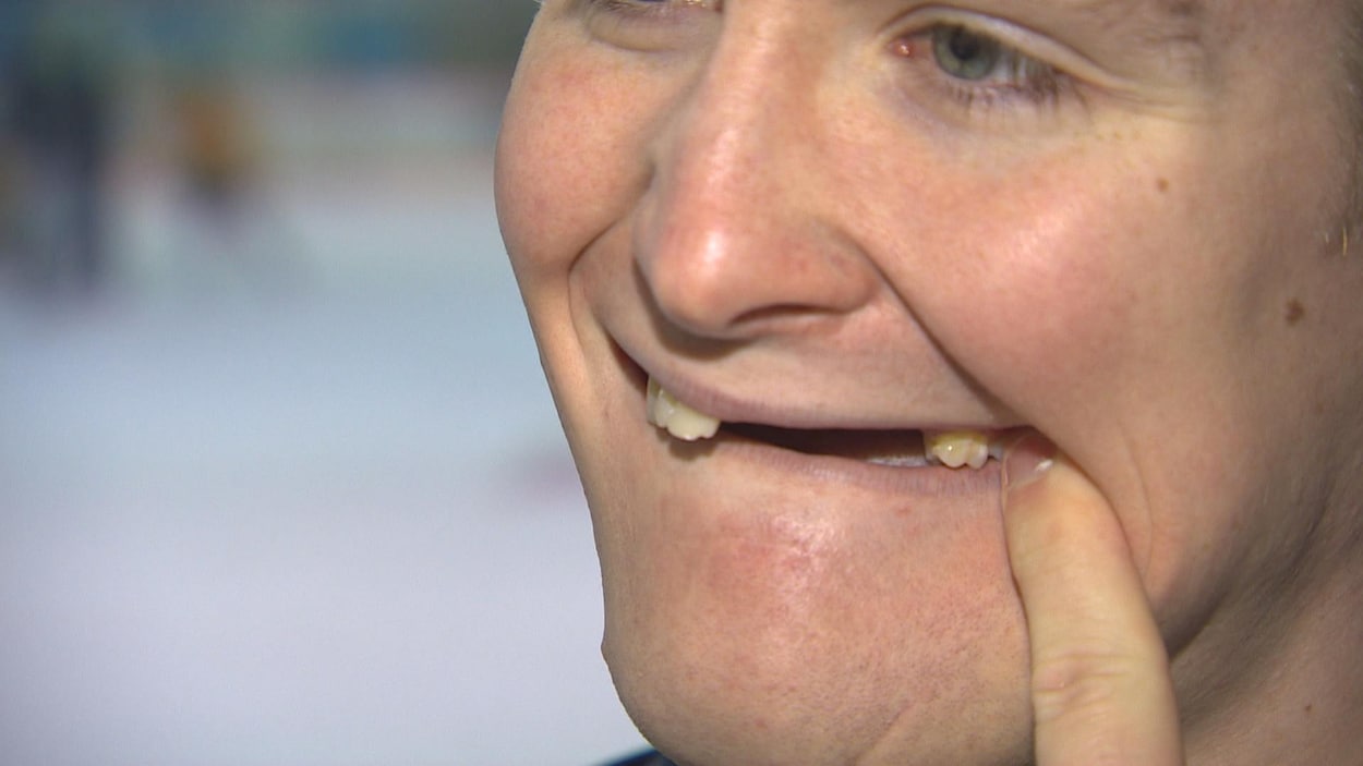 Un homme montre ses dents manquantes Un homme montre ses dents manquantes