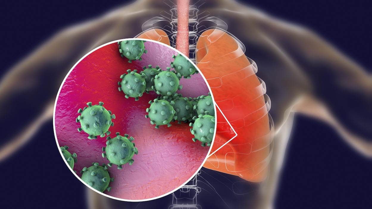 Illustration conceptuelle montrant un coronavirus dans des poumons.