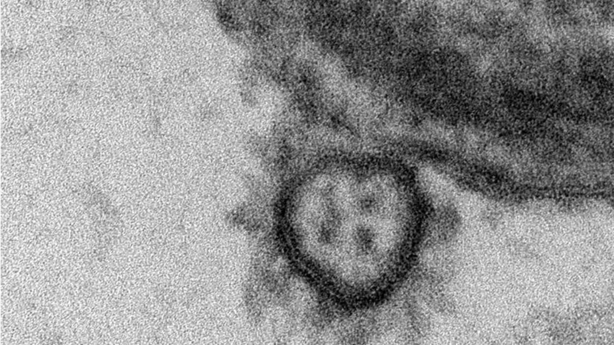 Gros plan du coronavirus SARS-CoV-2 observé à la surface d’une cellule épithéliale respiratoire humaine.