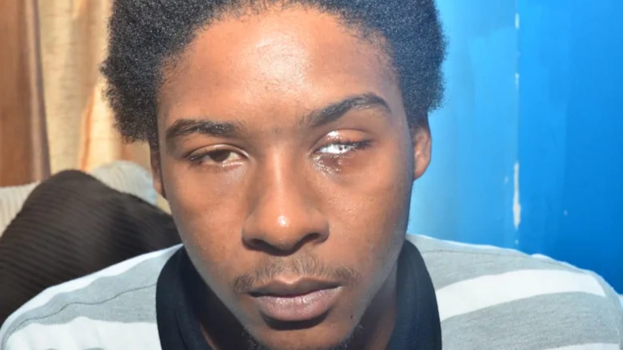 L’œil gauche de Dafonte Miller a été retiré lors d'une chirurgie.