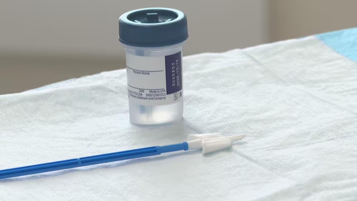 Nouveau test de dépistage du cancer du col de l’utérus en Alberta