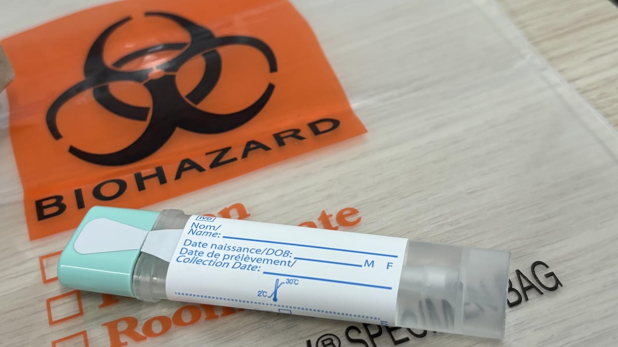 Cancer colorectal : 30 000 Québécois testés avec le nouveau programme de dépistage