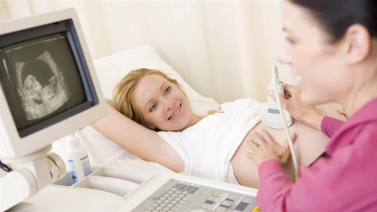 Une dame enceinte passe une échographique.