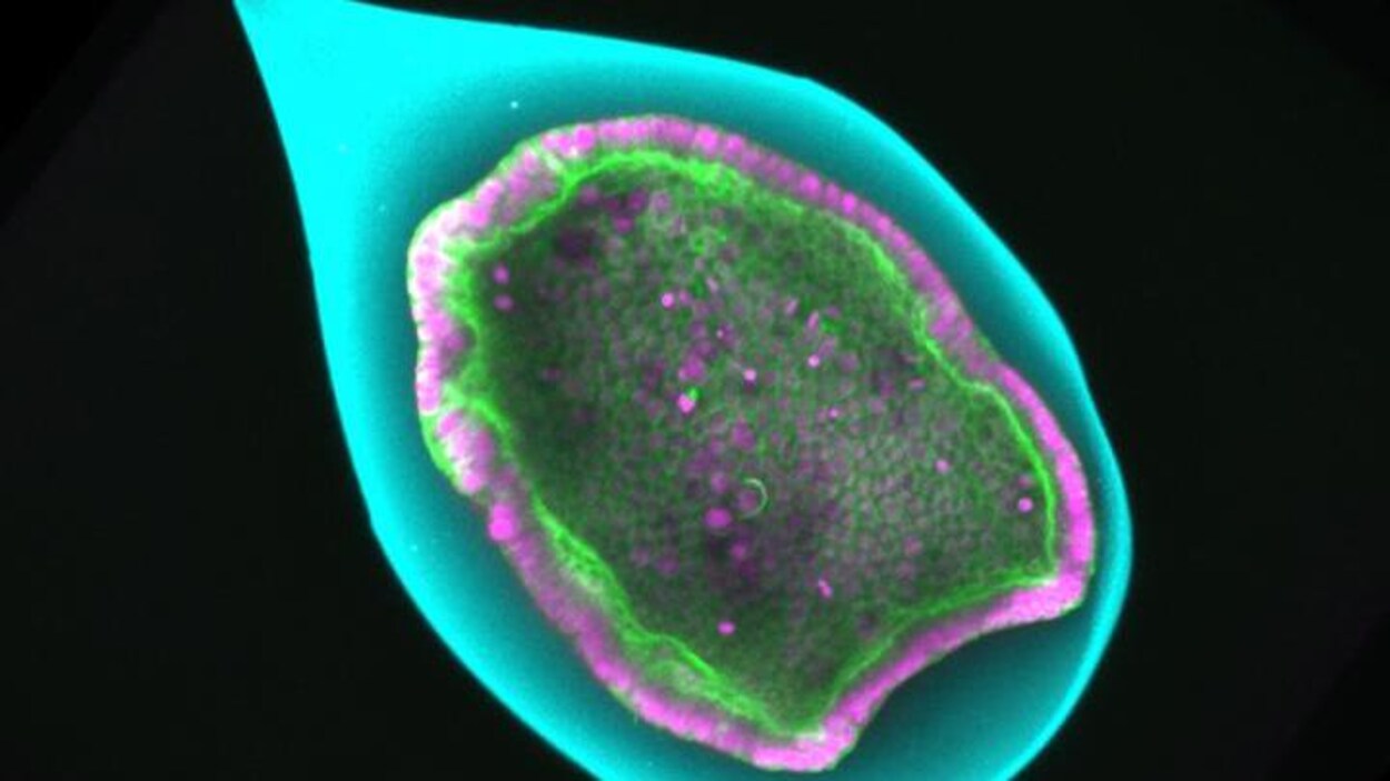 Une sphère dans laquelle se trouvent des cellules.